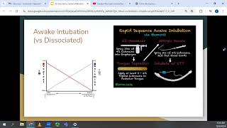 Dr Levitt  Airway  Intubation with Severe Metabolic Acidosis [upl. by Nerfe]