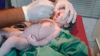 New born female baby came with breath hold take action emergancy drugs given through umblicol cord 😥 [upl. by Anitsirhc]