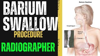 Barium Swallow Procedure  How to do Barium Swallow  Radiographer  X RAY Radiographer  Radiology [upl. by Truelove]