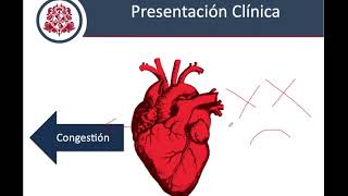 Insuficiencia Cardiaca  Fisiopatología Clínica y Diagnostico [upl. by Talie]