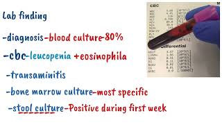 Enteric Fever  Thyphoid Fever  Pathogenesis and Management [upl. by Norby]