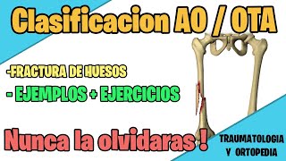 CLASIFICACION AO PARA FRACTURAS DE HUESOS  OTA MEJOR EXPLICADO [upl. by Eihctir315]