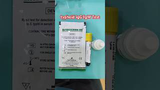 typhoid test igG IgM Test [upl. by Burg]