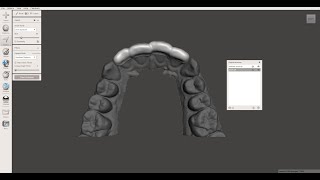 How to create a perfect shell around teeth using Meshmixer [upl. by Sitruc]