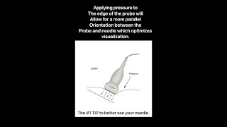 How to improve block needle visualization during ultrasound guided nerve block [upl. by Airoled]