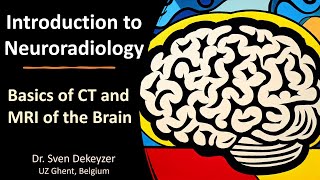 Basics of CT and MRI of the brain introduction to Neuroradiology [upl. by Akzseinga]