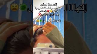 الديرما رولر للشعر [upl. by Adlen]