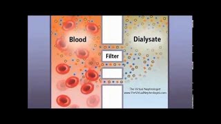 Hemodialysis Hemofilter and countercurrent animation [upl. by Alihs970]