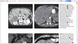 PANCREAS DIAGNOSTIC IMAGING SERIES [upl. by Narih778]