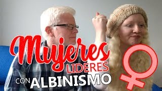 MUJERES LIDERES CON ALBINISMO [upl. by Auhel]