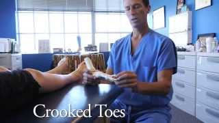 Spread Your Toes™ Series Crooked amp Overlapping Toes Conservative Care vs Conventional Care [upl. by Yhcir]