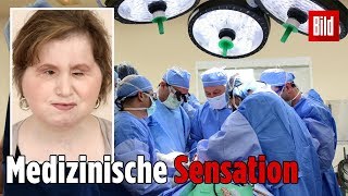 Ärzte schenken Katie ein neues Gesicht [upl. by Blancha596]