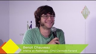 JFR 2017  BENOIT CHAUVEAU  Interne en Radiologie  CHU Clermont Ferrand [upl. by Nnylrahc]