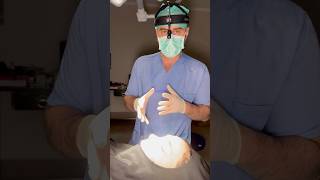 Revision Nasenkorrektur nachher🇩🇪Piezo Revision Rhinoplasty after images 🇪🇺revisionrhinoplasty [upl. by Luhem509]