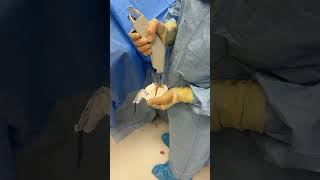 Orthopedic surgery operationtheatre operationtheatretechnician orthopedics shorts [upl. by Siravart]