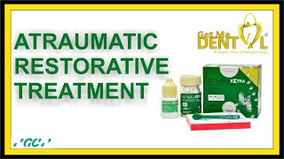 Atraumatic Restorative Treatment ART [upl. by Nimaj]