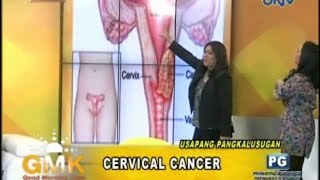 Understanding Cervical Cancer [upl. by Teteak]