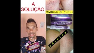 Cicatricure Gel para Estrias e Cicatrizes  Solução baratinha [upl. by Fondea]