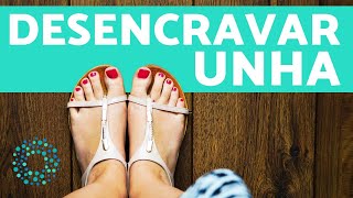 COMO DESENCRAVAR UNHA  remédios para unha encravada [upl. by Irehj]