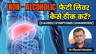 🔰NAFLD NonAlcoholic Fatty Liver Disease in Hindi🔰SymptomsTreatment of NonAlcoholic Fatty Liver [upl. by Sofko]