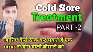 Treatment of Cold Sore PART2 [upl. by Allegra]