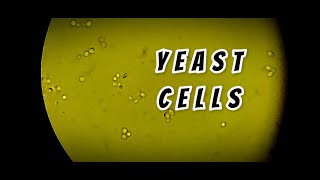 Yeast cells in stool routine Microscopy  labmedicine9265 [upl. by Linoel]