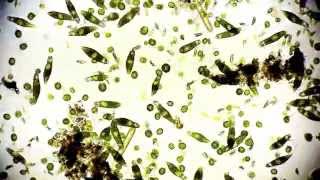 Mikroorganismen  microorganisms  Leben im Teich  life microcosmos 1080p Full HD [upl. by Ldnek]