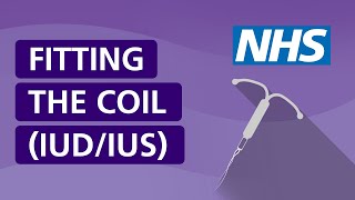 Fitting the coil IUDIUS  NHS [upl. by Fulcher]