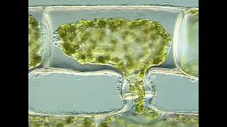 Scalariform Conjugation in Spirogyra [upl. by Robson348]