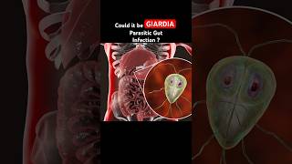 Giardia Infection is often mistaken for IBS Symptoms guthealth shorts youtubeshorts [upl. by Steinke]