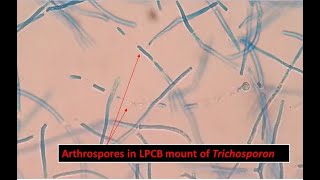 Arthroconidia of Trichosporon inkin Showing Long Cylindrical in Shape [upl. by Annaeerb]