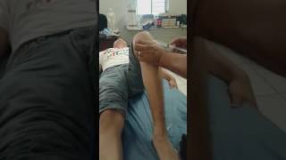 Técnica de Proloterapia para fortalecer rodilla en paciente con Síndrome de Elher Danlos [upl. by James599]