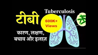 Tuberculosis causes symptoms treatment amp prevention in Hindi  टीबी के कारण लक्षण बचाव और इलाज़ [upl. by Cherry641]