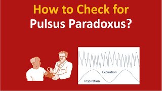 How to check for pulsus paradoxus [upl. by Nialb785]