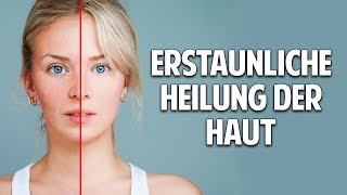 Probleme mit der Haut Erstaunliche Heilung durch natürliche Kosmetik [upl. by Oribelle913]