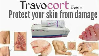 Travocort Isoconazole Nitrate and Diflucortolone Valerate cream for RednessinflamationNappy Rash [upl. by Notfa]