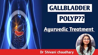 Gallbladder polyp  Ayurvedic treatment ayurveda ayurvedictreatment [upl. by Ardnoet]