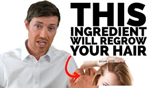 The BEST Hair Supplements Contain This Ingredient [upl. by Gibbeon178]