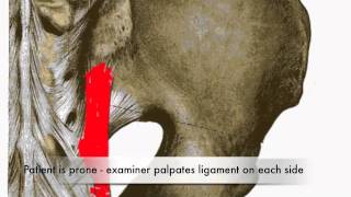 Provocation of Long Dorsal Sacroiliac Ligament Test CR [upl. by Etienne450]