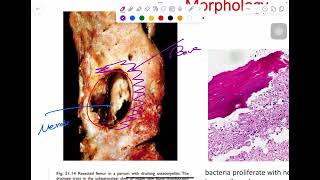 MSS pathology lab 2  part 1 [upl. by Harty]