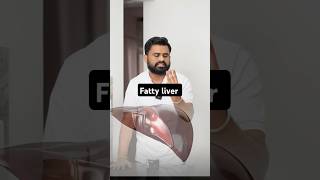 Fatty liver घर के खाने की ताकत को पहचानो drrobin health food ayurved doctor facts remedy [upl. by Claribel]