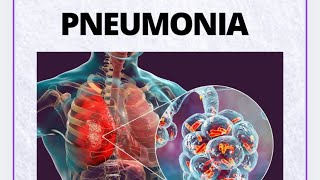 Pneumonia [upl. by Brenza]