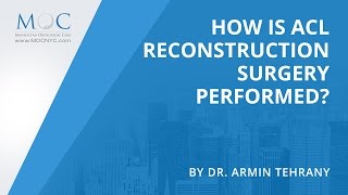 How is ACL Reconstruction Surgery Performed  Dr Armin Tehrany [upl. by Aznerol]