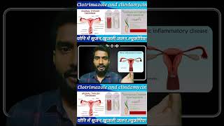 clotrimazole and clindamycin  cansoftcl  candidcl  vaginalinfection  shortvideo  viral [upl. by Auguste181]