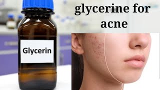 glycerine for acne amp glowing skinglycerine benefitshorts [upl. by Eniladam]