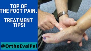 Top of the foot pain Treatment tips [upl. by Drexler]