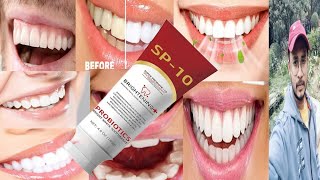 Sp10 Toothpaste  Honest Review [upl. by Niar]