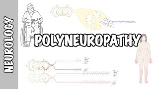 Approach to Polyneuropathy  causes pathophysiology investigations [upl. by Hgielah328]