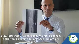 Operative Therapien der Gonarthrose  Arthrose im Kniegelenk [upl. by Rox]