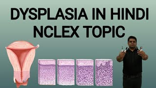 Dysplasia in hindi  Dysplasia Pathology in Hindi  Dysplasia Causes  Dysplasia kya hai [upl. by Scever]